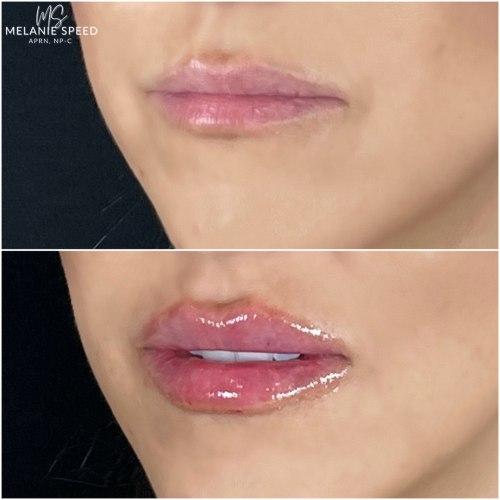 Application Tips: Achieving Flawless​ Lips⁣ with Ease