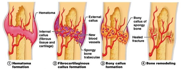 Key‍ Supplements to⁣ Accelerate Fracture Recovery