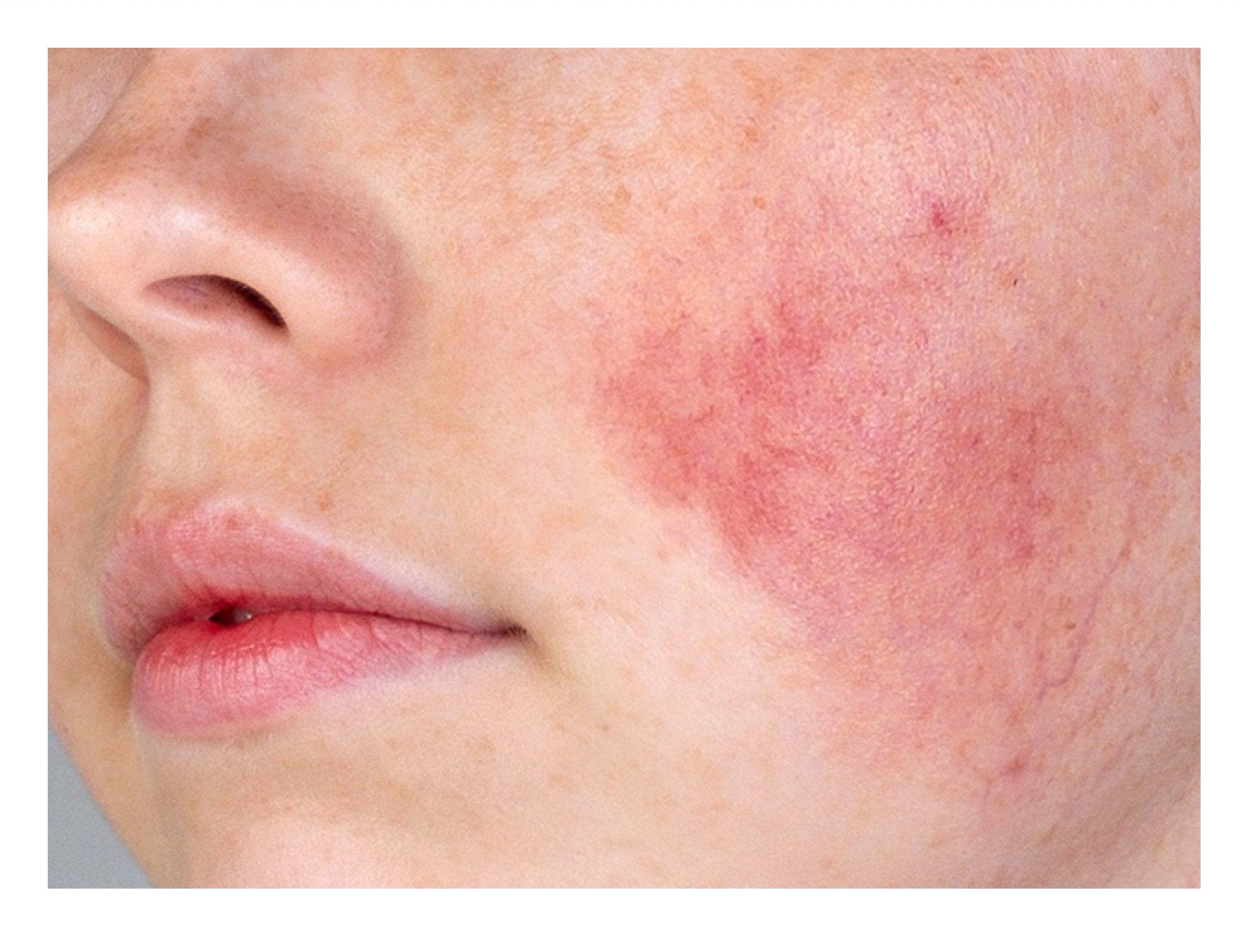 The Sensitivity Factor:‍ How This Bath oil ⁢Caters to Delicate Skin